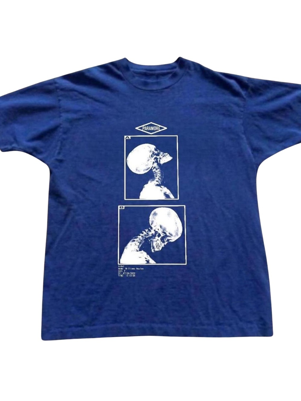 Gildan Royal Blue Graphic Tee with Skull X-Ray Print